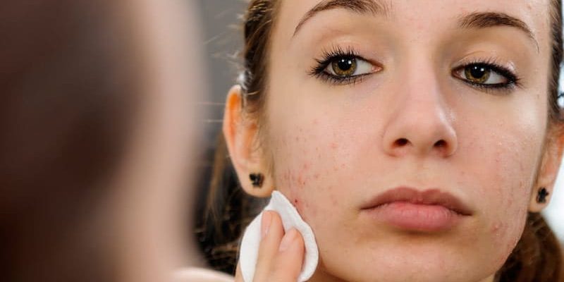 Roaccutane